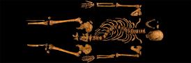 Richard III  Skeleton, University of Leicester copyright