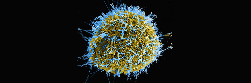 Ebola virus particles